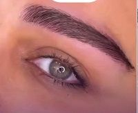 eyebrow transplant