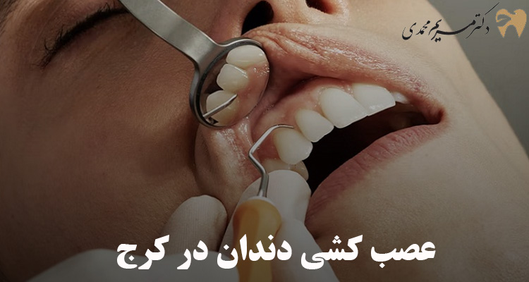 درمان ریشه دندان در کرج