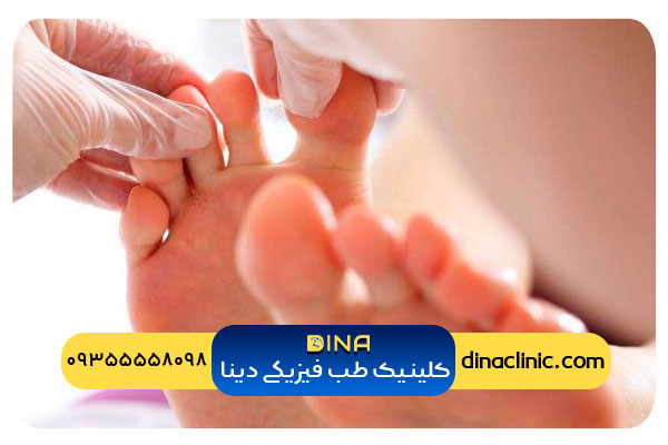 شایعترین علت درد انگشتان پا