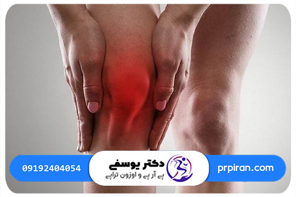 آشنایی با اجزای مفصل زانو