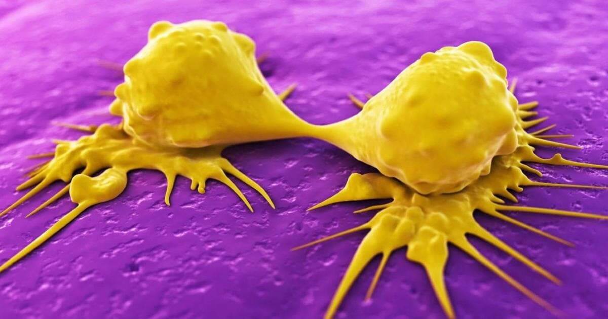 چه زمانی خارش پوست از علائم سرطان است؟