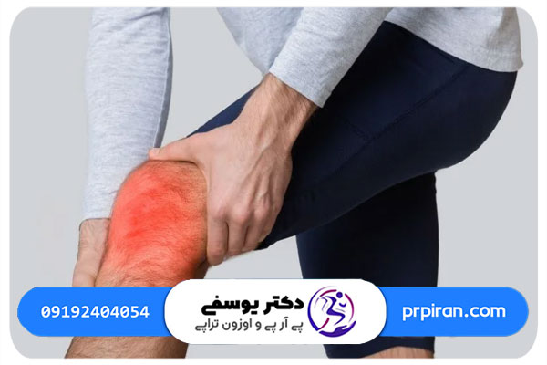 مراحل تزریق پی آر پی زانو در کلینیک دکتر یوسفی