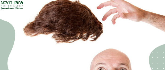 مزایای پروتز مو