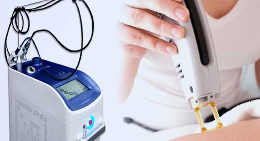 قیمت دستگاه لیزر مو