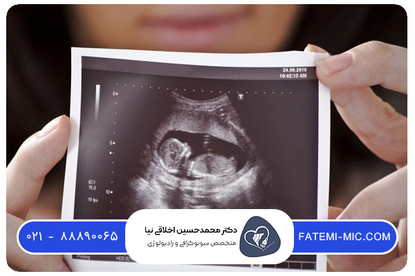تعیین جنسیت در سه ماهه اول بارداری